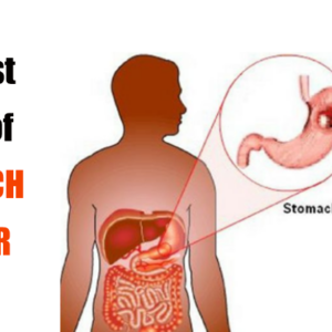 Cᴀɴᴄᴇʀ in the stomach develops silently. These are the first signs! You should be attentive!